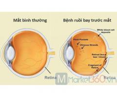 Bệnh Viện Mắt Uy Tín|Bệnh Viện Mắt BMT
