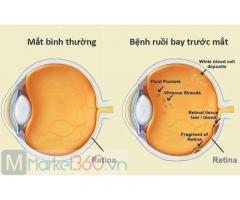 Bệnh viện mắt tại BMT | Bệnh Viện Mắt Tây Nguyên