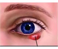 Phòng khám mắt - Bệnh Viện Mắt Tây Nguyên