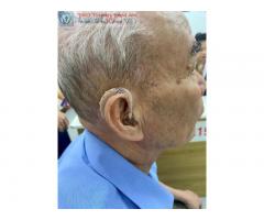 Bán máy trợ thính cho người nghe kém mức độ nặng tại Thanh Hóa.