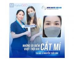 Những ưu điểm vượt trội khi cắt mí tại BVTM Nguyễn Tuấn Anh