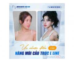 Ưu Nhược Điểm Của Nâng Mũi Cấu Trúc L Line