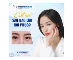 Lưu ý sau khi phẫu thuật thẩm mỹ mí mắt