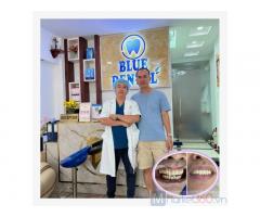 Địa chỉ làm răng uy tín tại quận Tân Bình? Nha khoa Blue dental – 169A Ba Vân, P.14, Q.Tân Bình, HCM.